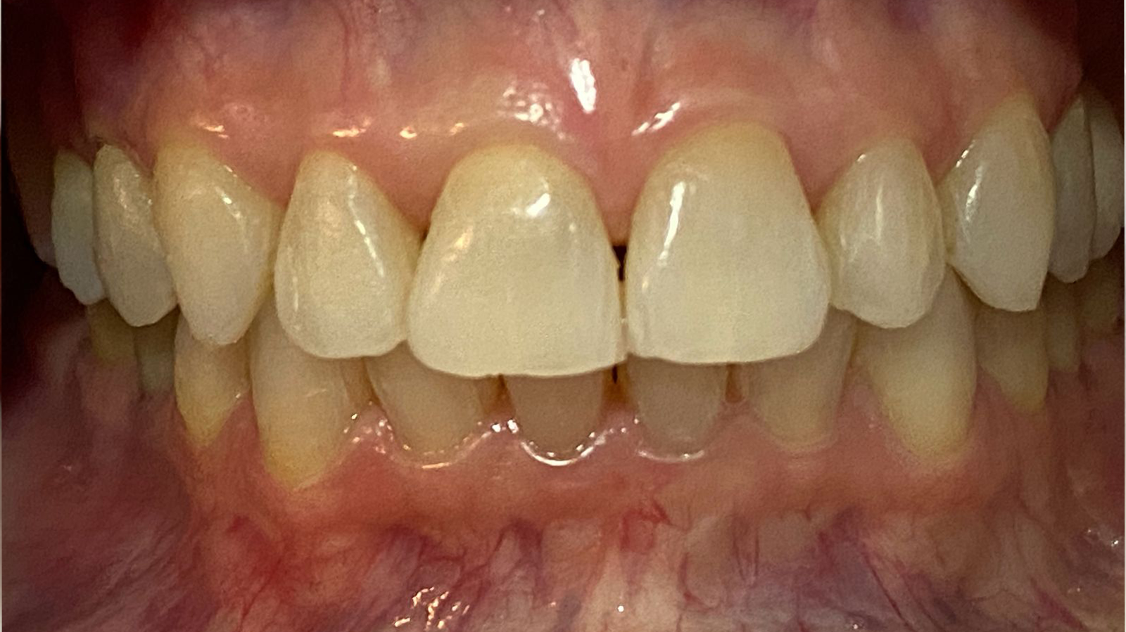 Sorriso renovado1