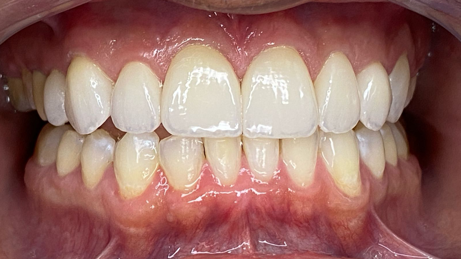 Sorriso renovado2